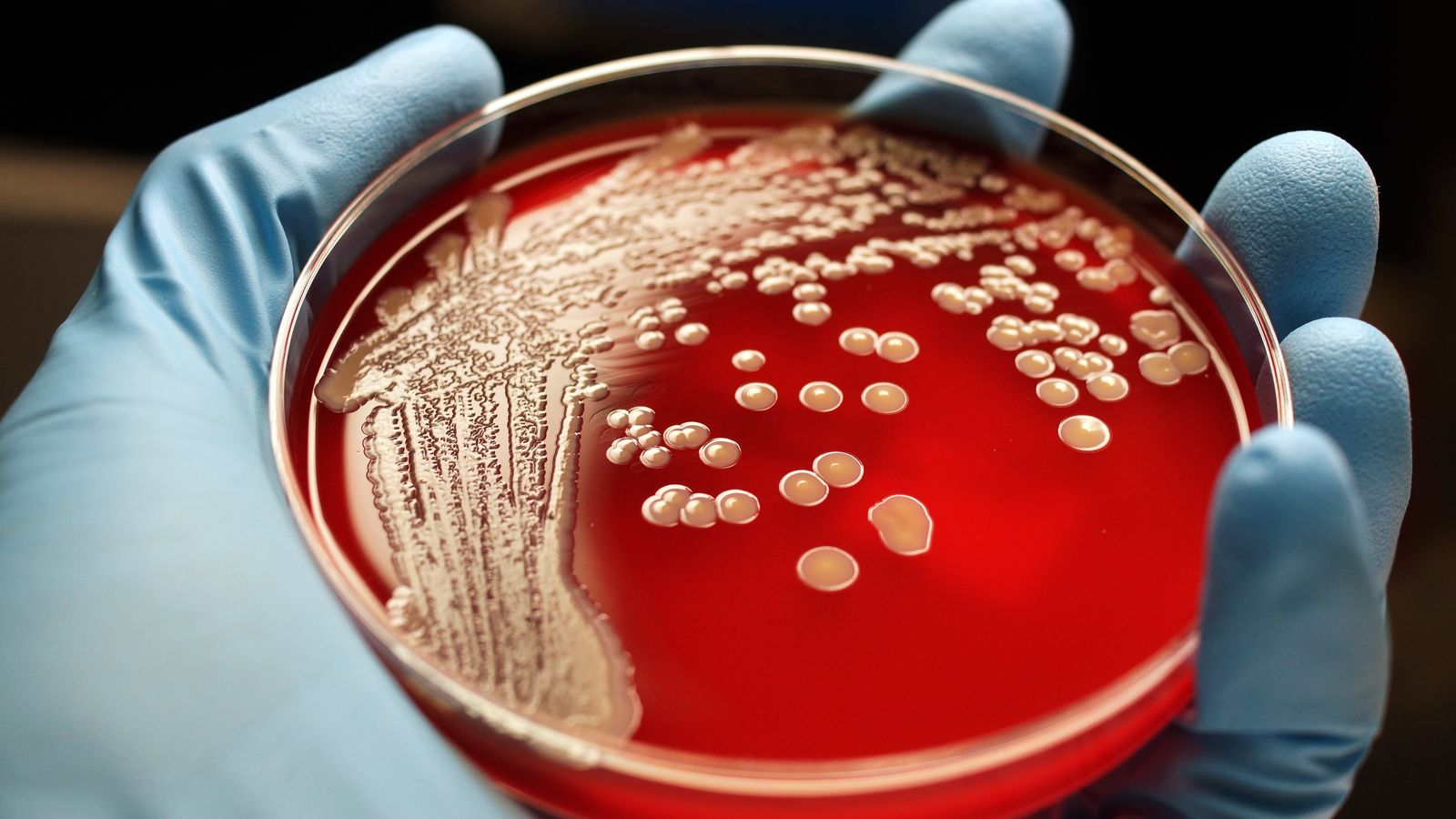 Alerta ante peligrosa bacteria que ya ha matado a 9 personas en London, ON. 