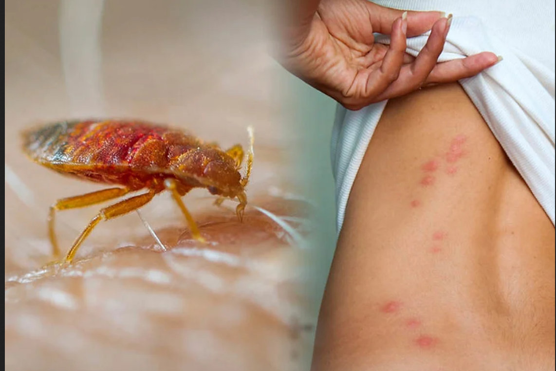 Toronto la ciudad de Canadá más afectada con la plaga de “bed bugs”